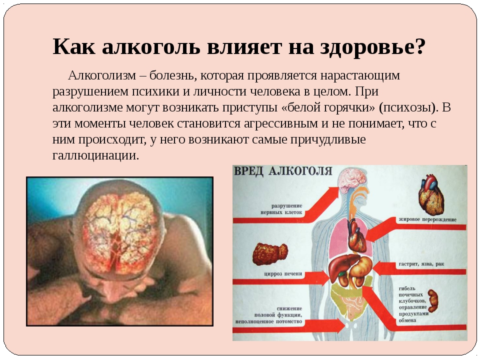 Алкогольная болезнь