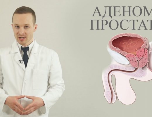 аденома простаты у мужчин