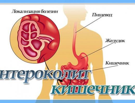 диета при заболевании кишечника