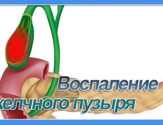 воспаление желчного пузыря
