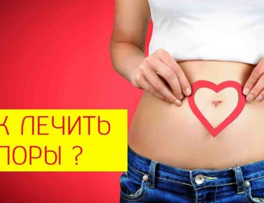 как избавиться от запоров
